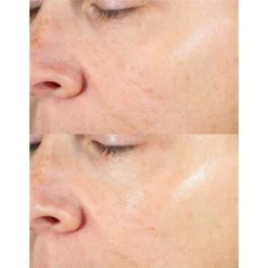 Derma E Vitamin C Liquid Face Peel - 1 Fl Oz -Pixi || Bumble and Bumble || American Crew Sales GUEST 354875e2 dff6 44a4 93a3 d92da5c2dfc5 3