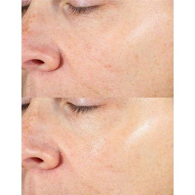 Derma E Vitamin C Gentle Daily Cleansing Paste - 4oz 3 Derma E Vitamin C Gentle Daily Cleansing Paste - 4oz - Image 3