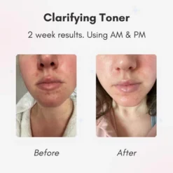 Beautaniq Beauty Clear Skies Skincare Bundle 16 Beautaniq Beauty Clear Skies Skincare Bundle -Pixi || Bumble and Bumble || American Crew Sales GUEST 63659896 6659 48dc 9666 8c07a642fddf