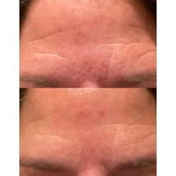 Derma E Ferulic Acid Resurfacing Pads - 50ct -Pixi || Bumble and Bumble || American Crew Sales GUEST 72eccd00 8bc1 45c2 8aec 21357547b0ec 1