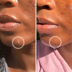 ZitSticka Goo Getter Surface Pimple Hydrocolloid Patch - 36ct 8 ZitSticka Goo Getter Surface Pimple Hydrocolloid Patch - 36ct -Pixi || Bumble and Bumble || American Crew Sales GUEST 8c7dd9cb d79f 4a22 9ae4 fb4b3fc2201a