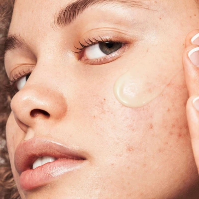 E.l.f. Blemish Breakthrough Acne Calming Water Cream - 1.69 Fl Oz 2 E.l.f. Blemish Breakthrough Acne Calming Water Cream - 1.69 Fl Oz - Image 2