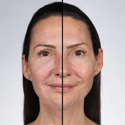 No7 Future Renew Damage Reversal Face Serum - 0.85 Fl Oz 4 No7 Future Renew Damage Reversal Face Serum - 0.85 Fl Oz - Image 4